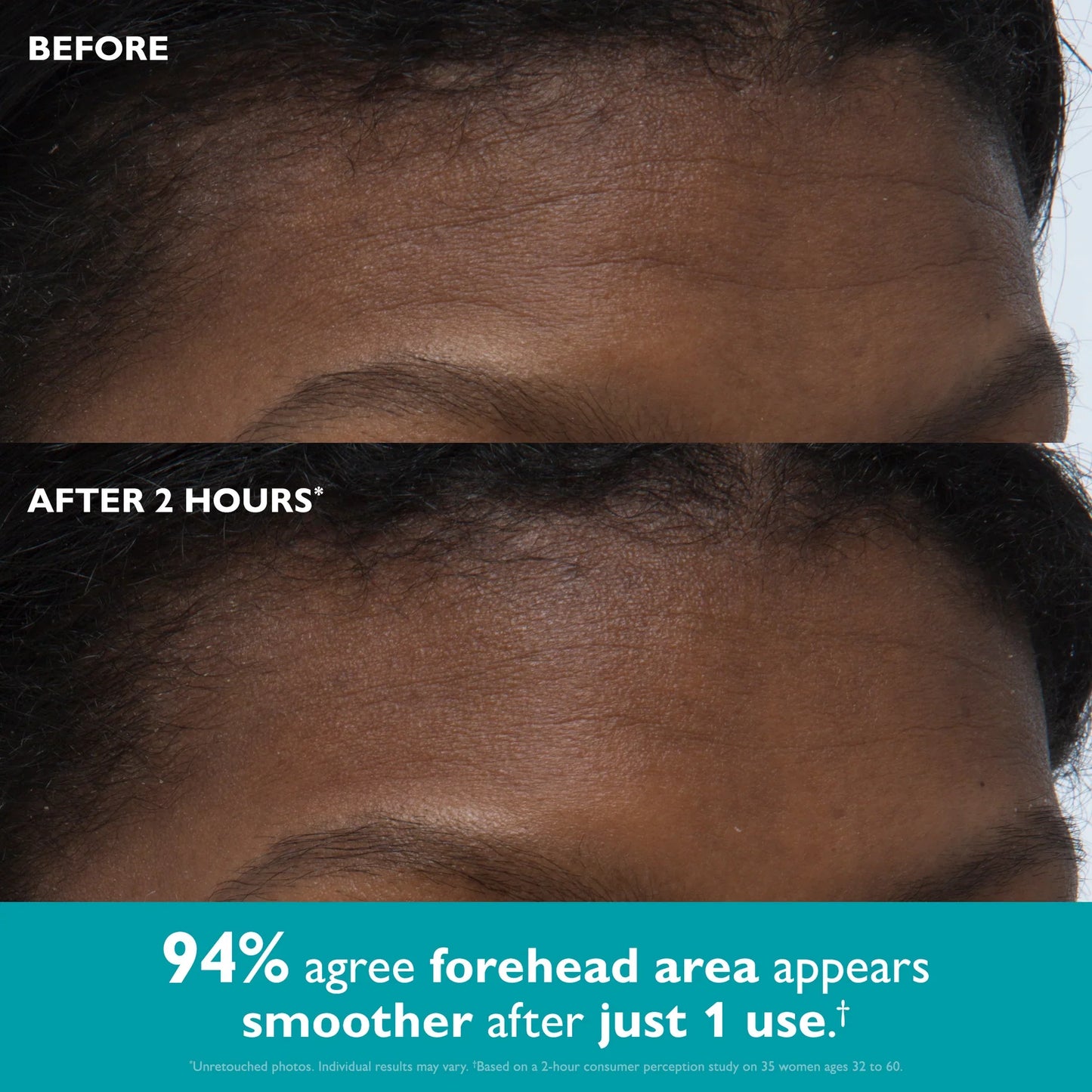 MORAE™ Peptide Skinjection Peptide Infused Face + Eye Tape