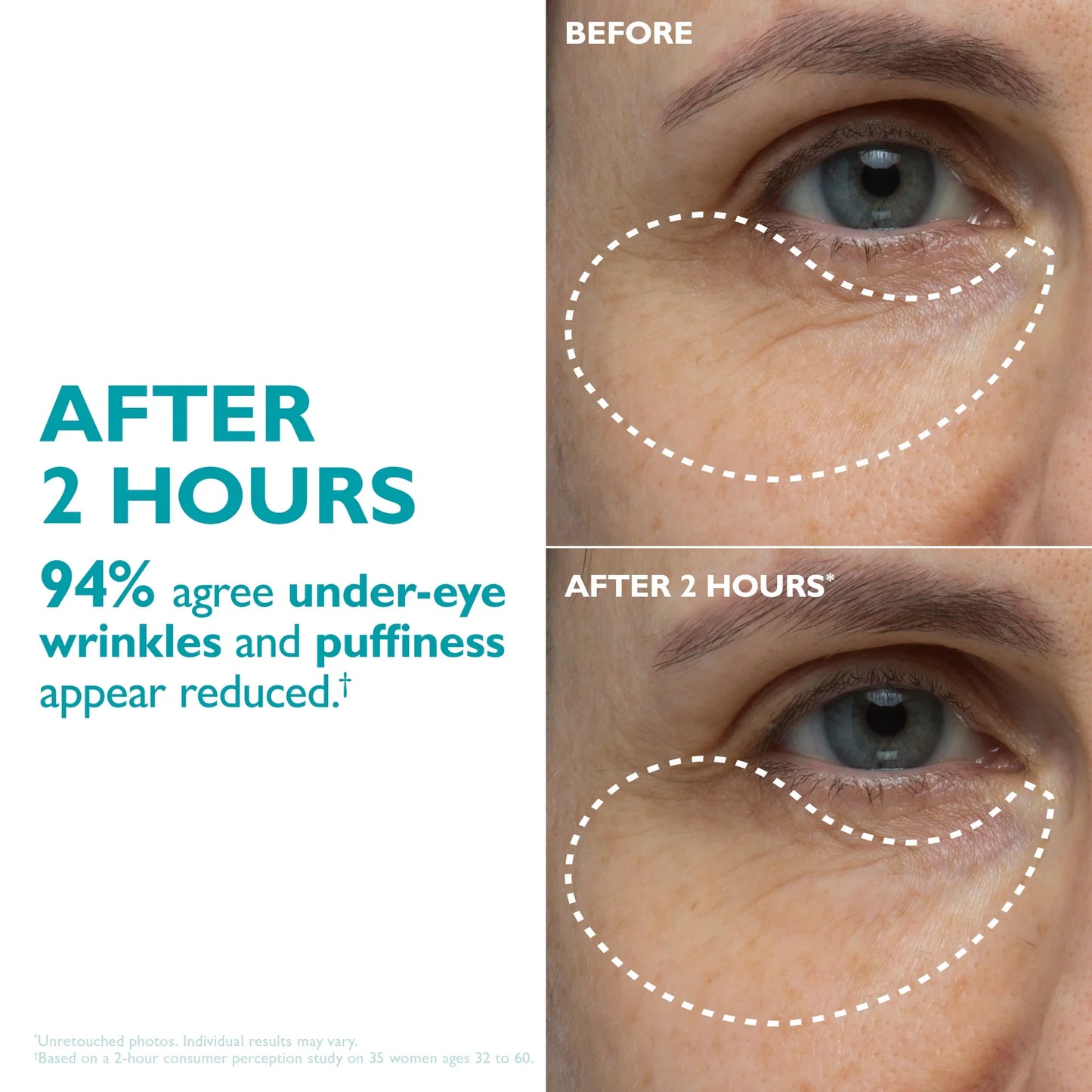 MORAE™ Peptide Skinjection Peptide Infused Face + Eye Tape