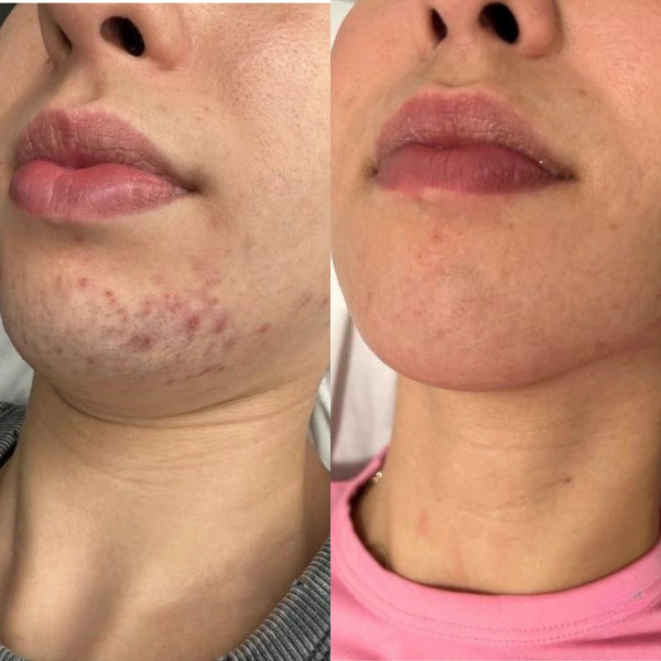 Customer before and after result
