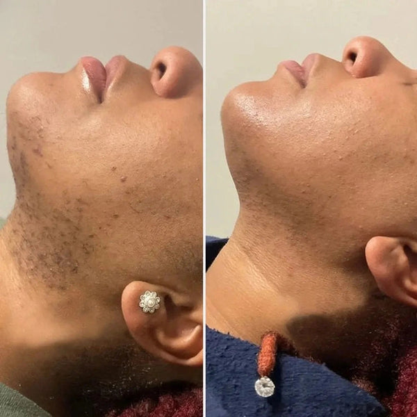 Customer before and after result