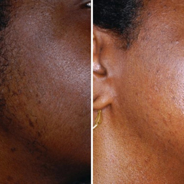 Customer before and after result